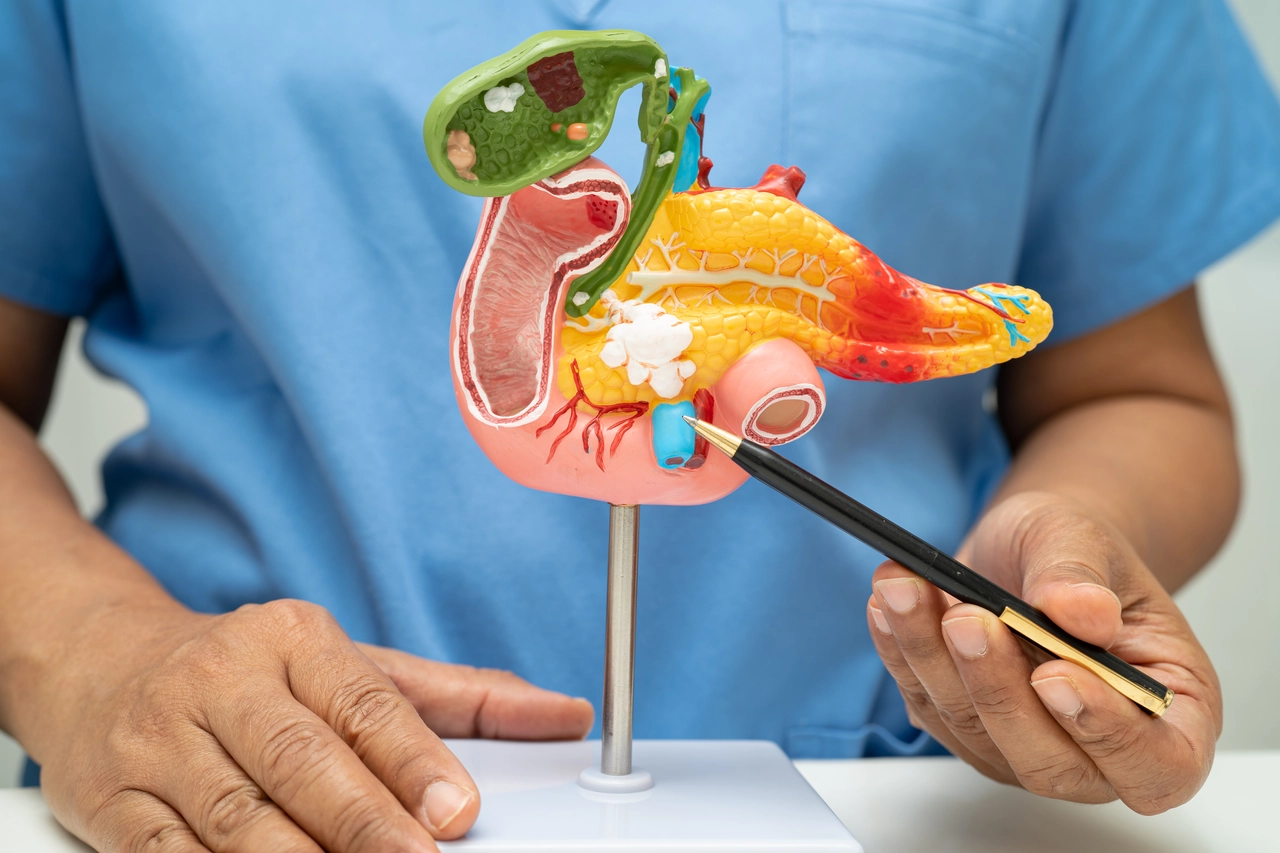 Il tumore al pancreas è tra i più aggressivi: ecco le abitudini fondamentali per evitarlo